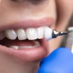 The Benefits of Professional Dental Cleanings