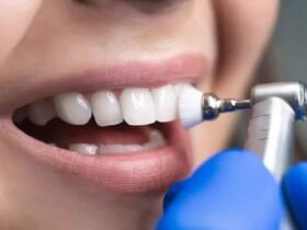 The Benefits of Professional Dental Cleanings