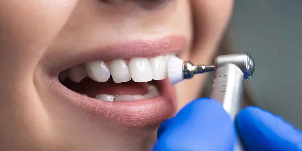 The Benefits of Professional Dental Cleanings